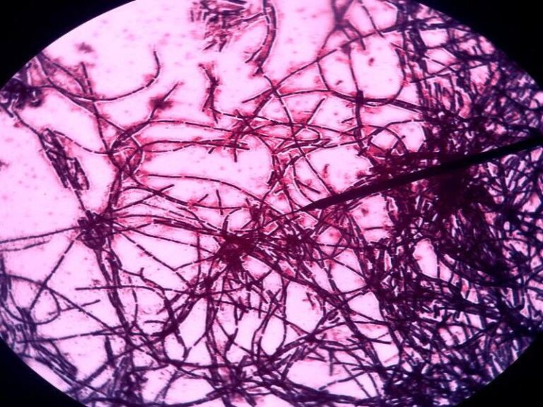 Bacillus Subtillis