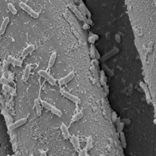 Bacillus megaterium