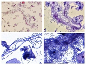 microorganismos eficientes en la agricultura pdf