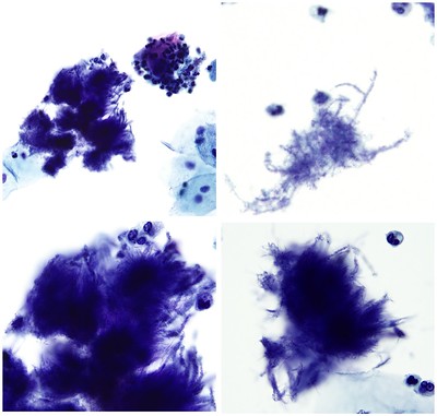 Microorganismos anaerobios