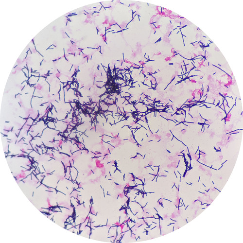 bacillus licheniformis agricultura