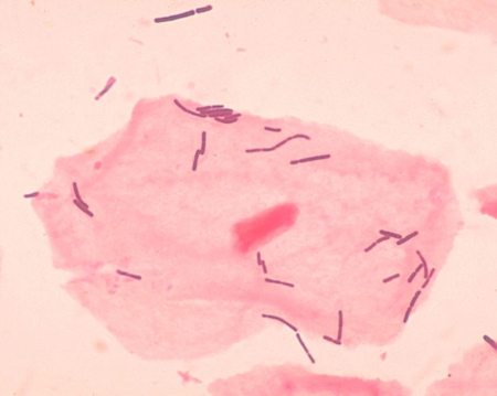 lactobacillus casei